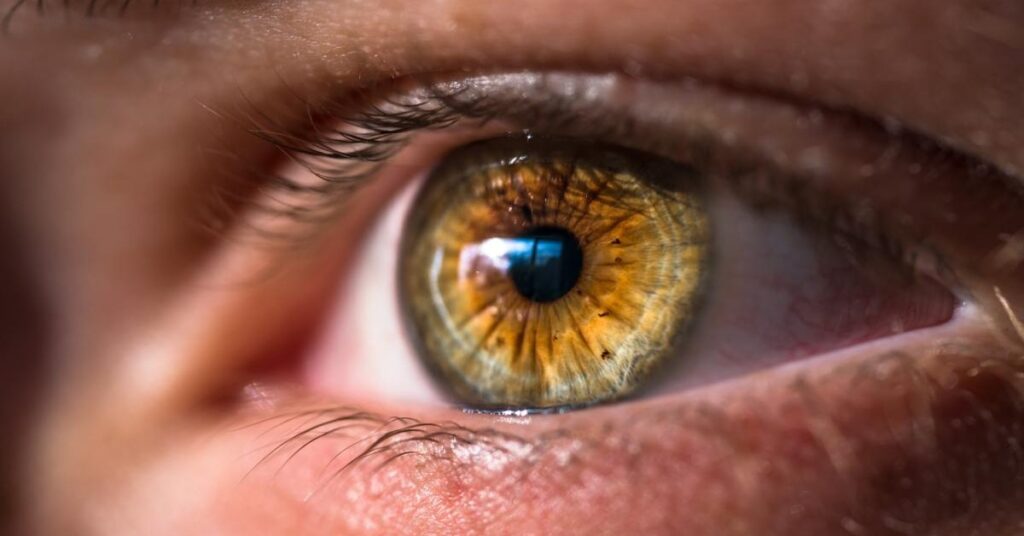Why Become a Dry Eye Optometrist?